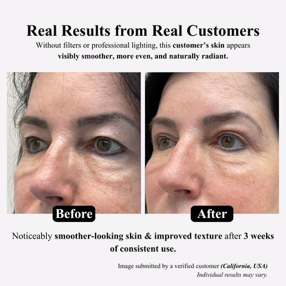 Virelle™ Skin Firming & Lifting Serum